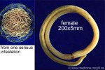 Enlarged Image of 'Ascaris lumbricoides'