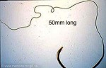 Enlarged Image of 'Trichuris trichuria'