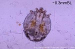 Enlarged Image of 'Sarcoptes scabiei'