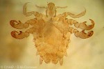 Enlarged Image of 'Pthirus pubis'