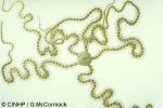 Enlarged Image of 'Macrophiothrix longipeda'