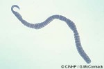 Enlarged Image of 'Nemertean species'
