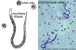 Enlarged Image of 'Wuchereria bancrofti'