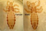 Enlarged Image of 'Pediculus humanus'